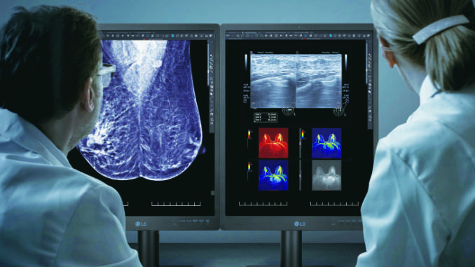 El LG 21HQ613D es un monitor diseñado para hacer mamografías digitales y tomosíntesis mamarias que destaca por su gran calidad de imagen, sus nuevas funcionalidades y su facilidad de uso y calibración. Foto: LG