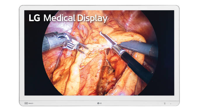 El nuevo panel quirúrgico 4K de LG 32HR734S es la opción ideal para la visualización perfecta de aplicaciones quirúrgicas como laparoscopias o endoscopias. Foto: LG