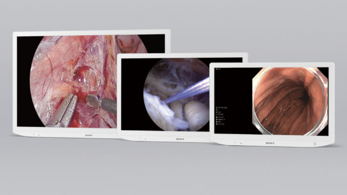 Sony refuerza su apuesta por el sector médico con una nueva gama de monitores de alta precisión visual, optimizados para facilitar su uso en entornos clínicos. Foto: Sony Healthcare